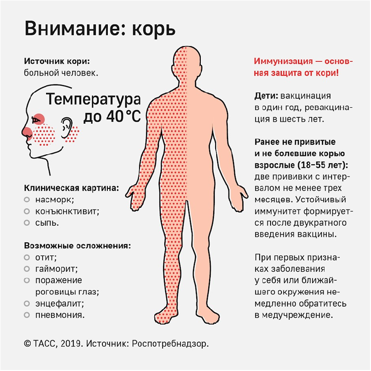 Что такое корь? Что такое корь?